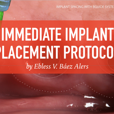 Screen-Shot-2020-04-17-at-6.52.43-PM IMMEDIATE IMPLANT PLACEMENT PROTOCOL