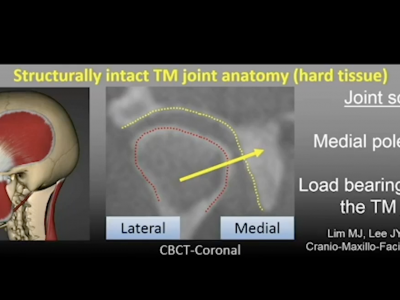 Screen-Shot-2020-04-24-at-4.41.13-PM Demystifying Occlusion