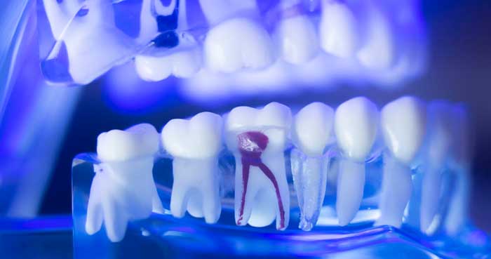 endodontics endodontics